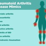Arthritis rheumatoid symptoms early ra signs fingers scleroderma pain esclerodermia joint wrists does skin joints